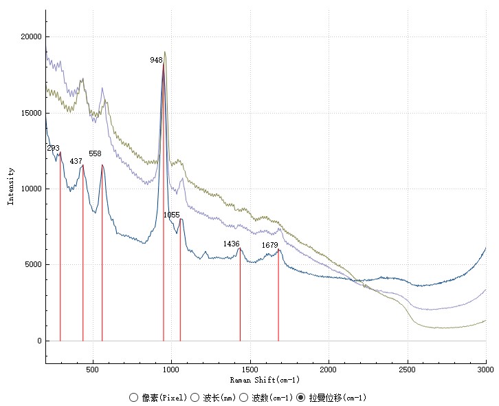 图4 3例结石拉曼光谱.jpg